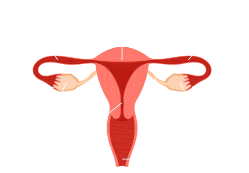 Tubal Recanalization