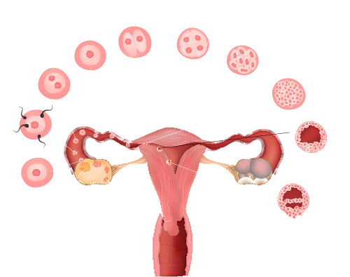 Tubal Recanalization