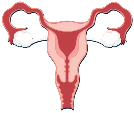 Ectopic Pregnancy