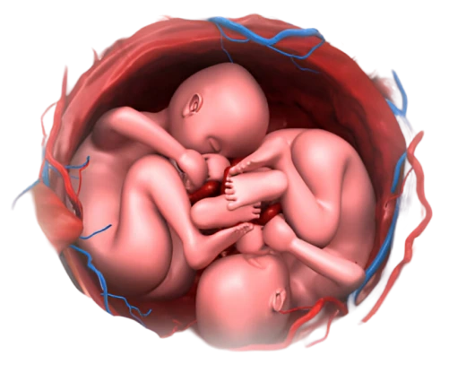 Twin-Pregnancy