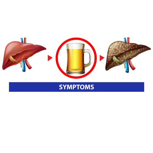 Alcoholic liver disease - lifeplus