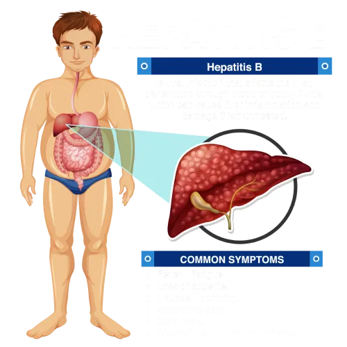 Hepatitis
