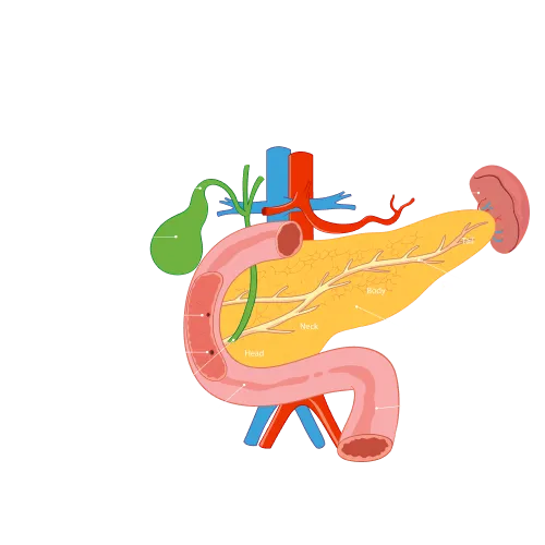 Pancreatitis