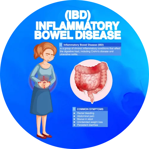 Crohn's disease