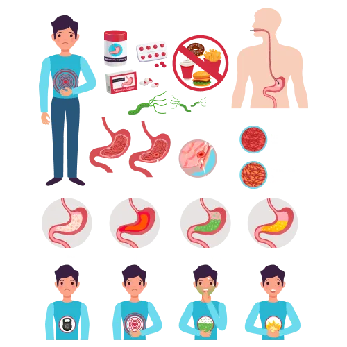 Endoscopy - lifeplus