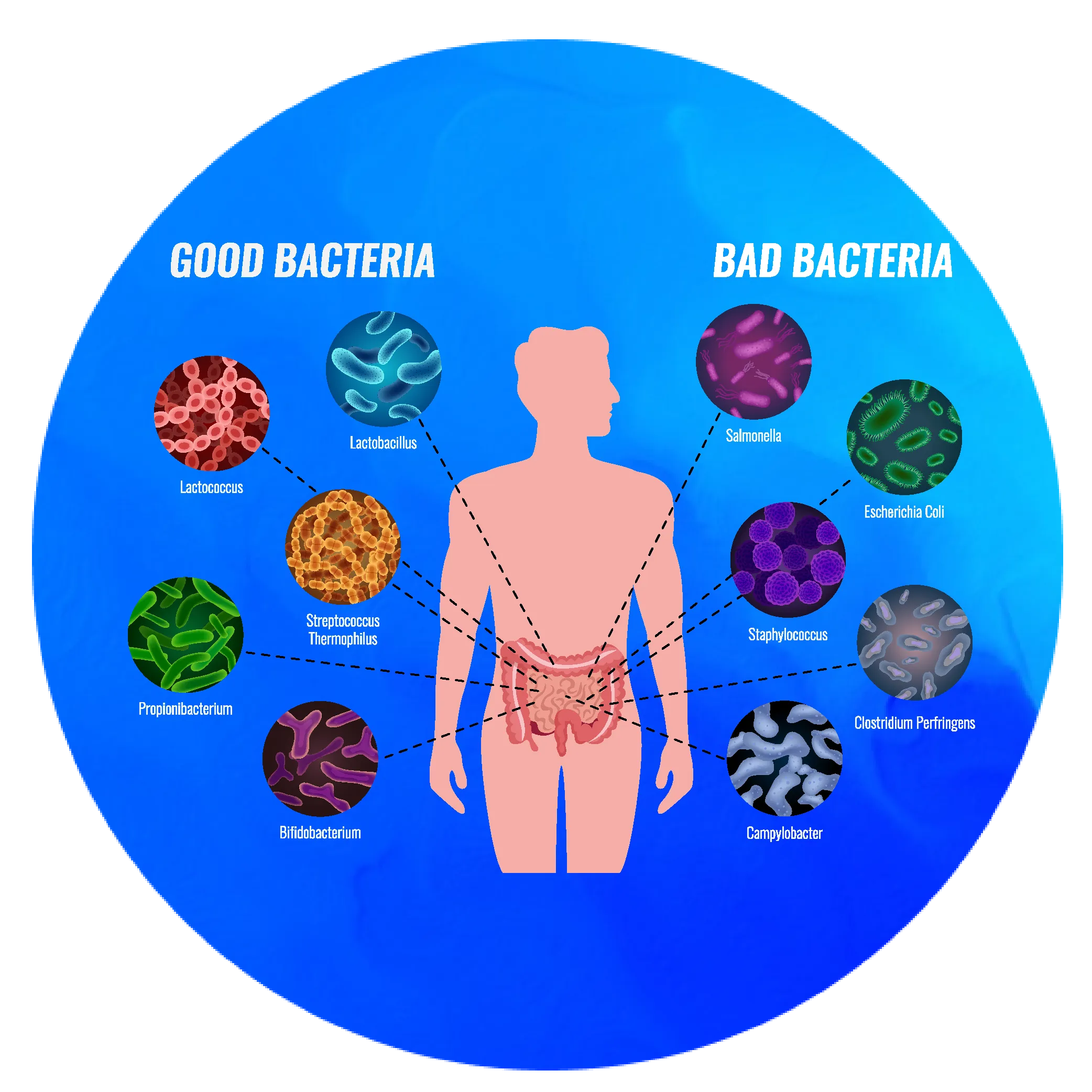 Acute Gastroenteritis