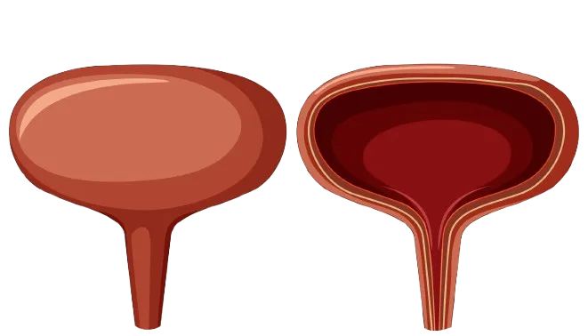 Urinary Incontinence